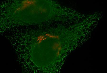 Golgi Apparatus