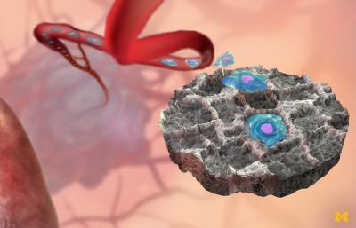 Implantable Device