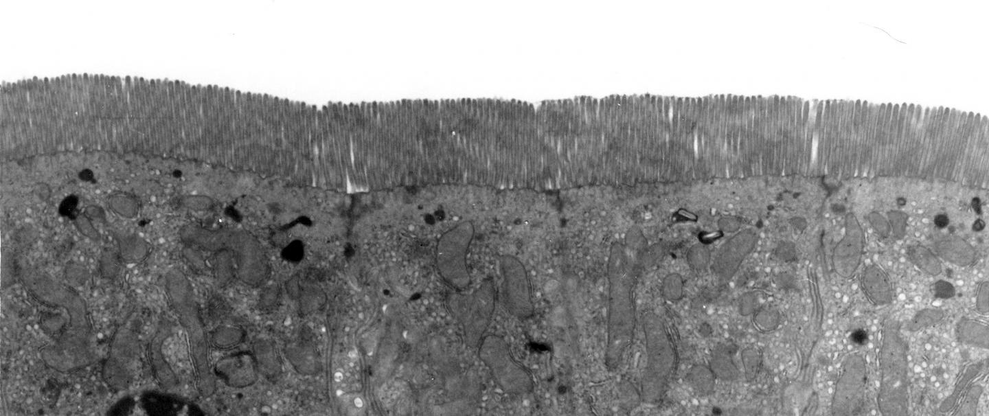Epithelial Lining
