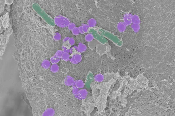 Microbiota