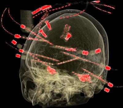 From Thought to Speech in 600 Milliseconds (3 of 4)